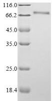 Human Proliferation marker protein Ki-67 (MKI67), partial Recombinant Protein, N-His-SUMO, aa 2891–3256 - BioCrest Sci