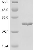 Human Centrin-3 (CETN3) Recombinant Protein, C-His - BioCrest Sci