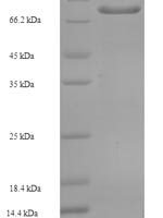 Human Zinc finger protein 165 (ZNF165) Recombinant Protein - BioCrest Sci