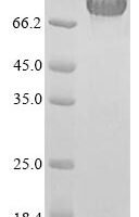 Aspergillus kawachii Probable endo-beta-1,4-glucanase D (eglD) Recombinant Protein, N-His - BioCrest Sci