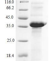 Bacillus subtilis Penicillin-binding protein 1A/1B (ponA), partial Recombinant Protein - BioCrest Sci