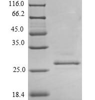 Pig Prolactin (PRL) Recombinant Protein, N-His - BioCrest Sci
