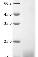 Human Enamelin (ENAM), partial Recombinant Protein, C-His, aa 1043–1142, Baculovirus - BioCrest Sci