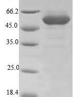 Arabidopsis thaliana Flavonol 3-O-glucosyltransferase UGT71C1 (UGT71C1) Recombinant Protein - BioCrest Sci