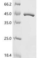 Paramecium bursaria Chlorella virus 1 mRNA-capping enzyme (A103R) Recombinant Protein - BioCrest Sci
