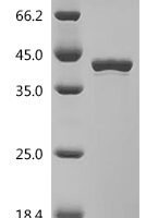 Human Fatty acid synthase (FASN), partial Recombinant Protein, C-His - BioCrest Sci