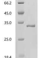 Mouse Interleukin-34 (Il34) Recombinant Protein, C-His - BioCrest Sci