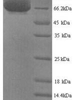 Human Inactive tyrosine-protein kinase 7 (PTK7), partial Recombinant Protein - BioCrest Sci