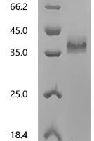 Mouse Tumor necrosis factor receptor superfamily member 16 (Ngfr), partial, Biotinylated Recombinant Protein, C-10His-Avi - BioCrest Sci