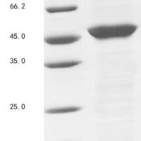 Nostoc sp. Protein patA (patA) Recombinant Protein - BioCrest Sci