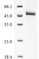 Human Cytochrome P450 3A43 (CYP3A43) Recombinant Protein - BioCrest Sci