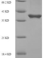 Human Butyrophilin subfamily 3 member A2 (BTN3A2), partial Recombinant Protein, N-His-SUMO - BioCrest Sci