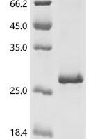 Human Voltage-dependent T-type calcium channel subunit alpha-1I (CACNA1I), partial Recombinant Protein - BioCrest Sci