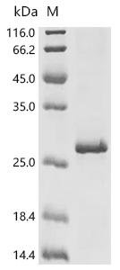 Human Voltage-dependent T-type calcium channel subunit alpha-1I (CACNA1I), partial Recombinant Protein, Homo sapiens (Human), E.coli, C-terminal 6xHis-tagged, 23.5 kDa, purity >≥ 90% as determined by SDS-PAGE.