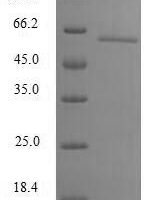 Human CCR4-NOT transcription complex subunit 8 (CNOT8) Recombinant Protein - BioCrest Sci
