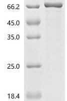 Human Glycylpeptide N-tetradecanoyltransferase 2 (NMT2) Recombinant Protein - BioCrest Sci