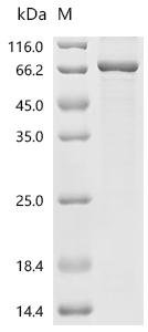 Human Glycylpeptide N-tetradecanoyltransferase 2 (NMT2) Recombinant Protein, Homo sapiens (Human), E.coli, C-terminal 6xHis-tagged, 63.9 kDa, purity >≥ 85% as determined by SDS-PAGE.