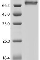 Mouse Ly-6/neurotoxin-like protein 1 (Lynx1) Recombinant Protein, N-His-PDI - BioCrest Sci