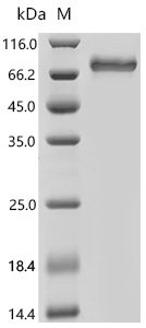 Mouse Ly-6/neurotoxin-like protein 1 (Lynx1) Recombinant Protein, N-His-PDI, Yeast, N-terminal 6xHis-PDI-tagged, 67.2 kDa, purity >≥ 90% as determined by SDS-PAGE.