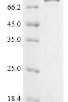 Mouse Heterogeneous nuclear ribonucleoprotein L-like (Hnrpll) Recombinant Protein - BioCrest Sci
