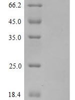 Severe acute respiratory syndrome coronavirus 2 Spike glycoprotein (S) (N501Y,P681H), partial Recombinant Protein, C-10His - BioCrest Sci