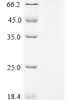 Human Bifunctional 3'-5' exonuclease/ATP-dependent helicase WRN (WRN), partial Recombinant Protein, N-MBP/C-His - BioCrest Sci