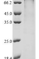 Human Activating transcription factor 7-interacting protein 2 (ATF7IP2) Recombinant Protein - BioCrest Sci