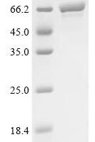 Stenotrophomonas maltophilia Chaperonin GroEL (groEL), partial Recombinant Protein - BioCrest Sci