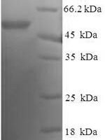 Human DnaJ homolog subfamily B member 2 (DNAJB2) Recombinant Protein - BioCrest Sci