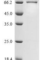 Mouse La-related protein 6 (Larp6) Recombinant Protein - BioCrest Sci
