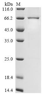 Mouse La-related protein 6 (Larp6) Recombinant Protein, Mus musculus (Mouse), E.coli, N-terminal 6xHis-tagged, 58.8 kDa, purity >≥ 85% as determined by SDS-PAGE.