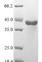 Human Aspartoacylase (ASPA) Recombinant Protein, N-10His/C-Myc, aa 1–313, Mammalian cell - BioCrest Sci