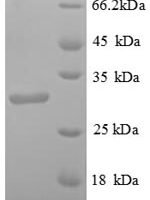 Streptomyces avidinii Streptavidin Recombinant Protein - BioCrest Sci