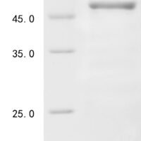 Human Coagulation factor VIII (F8) Recombinant Protein, N-His-GST - BioCrest Sci
