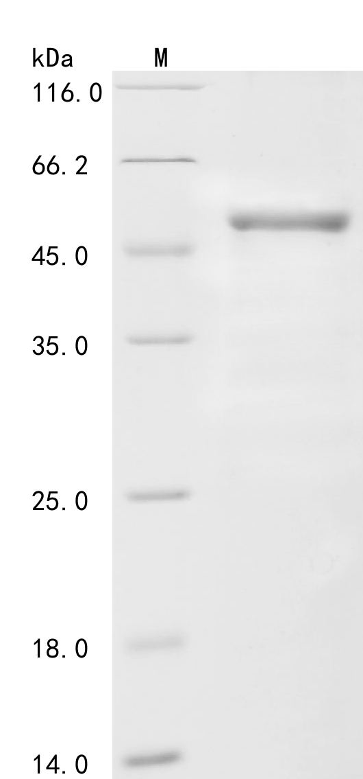 Human Coagulation factor VIII (F8) Recombinant Protein, N-His-GST, Homo sapiens (Human), E.coli, N-terminal 6xHis-GST-tagged, 56.2 kDa, purity >≥ 85% as determined by SDS-PAGE.