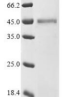 Canine coronavirus Nucleoprotein(N) Recombinant Protein - BioCrest Sci
