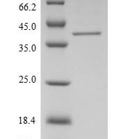 Human Putative ribosomal RNA methyltransferase 1 (FTSJ1) Recombinant Protein - BioCrest Sci