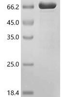 Human Sterol carrier protein 2 (SCP2) Recombinant Protein - BioCrest Sci