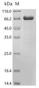 Human Sterol carrier protein 2 (SCP2) Recombinant Protein, Homo sapiens (Human), E.coli, C-terminal 6xHis-tagged, 65.9 kDa, purity >≥ 85% as determined by SDS-PAGE.