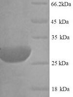 Rat Type II iodothyronine deiodinase (Dio2) Recombinant Protein - BioCrest Sci