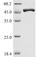 Avian infectious bronchitis virus Nucleoprotein (N) Recombinant Protein, C-His, aa 1–409, strain H52 - BioCrest Sci