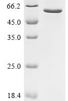 Human Plexin domain-containing protein 1 (PLXDC1), partial Recombinant Protein, N-10His/C-Myc - BioCrest Sci
