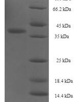 Human Integrin alpha-IIb (ITGA2B), partial Recombinant Protein, N-His-SUMO - BioCrest Sci