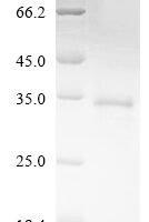 Human Nuclear receptor ROR-alpha (RORA),Partial Recombinant Protein - BioCrest Sci