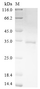 Human Nuclear receptor ROR-alpha (RORA),Partial Recombinant Protein, Homo sapiens (Human), Yeast, N-terminal 6xHis-tagged, 35.4 kDa, purity >≥ 85% as determined by SDS-PAGE.
