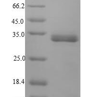 Yersinia enterocolitica Attachment invasion locus protein (ail) Recombinant Protein - BioCrest Sci