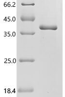 Human Complement C4-B (C4B), partial Recombinant Protein, C-His - BioCrest Sci