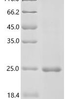 Human Platelet-derived growth factor D (PDGFD), partial Recombinant Protein, C-His - BioCrest Sci