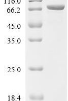 Escherichia coli Glutamine--tRNA ligase (glnS) Recombinant Protein - BioCrest Sci