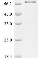 Human Drebrin-like protein (DBNL) Recombinant Protein - BioCrest Sci